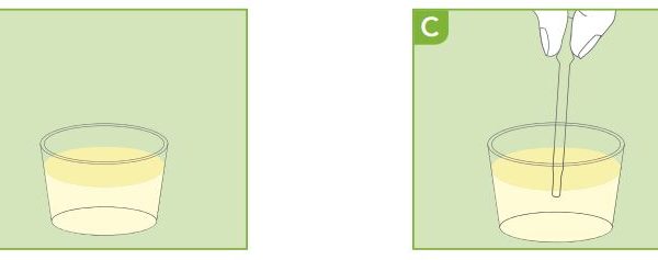 Nieren Albumine test - Kidneys Albumin - zelftest - Prima Lab - 1 testkit