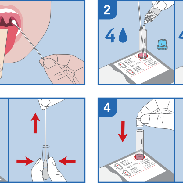 Streptokokken A test zelftest Prima Lab