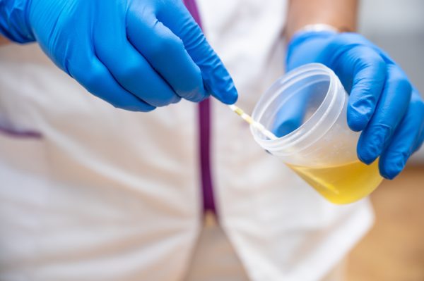 alcoline drugs urine test